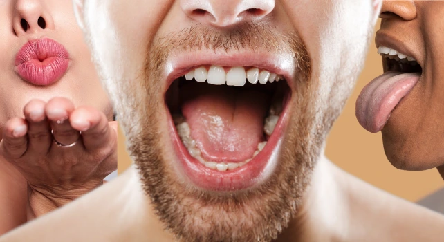 Pessoas com a boca aberta.