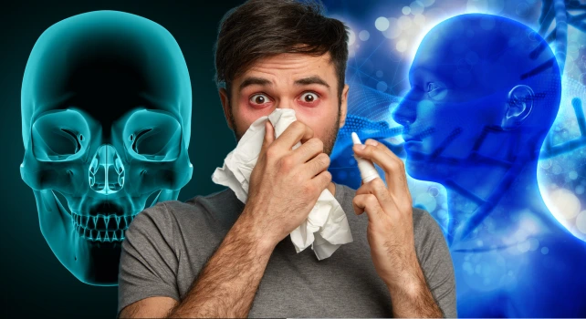 Homem com sintomas de sinusite odontogênica.