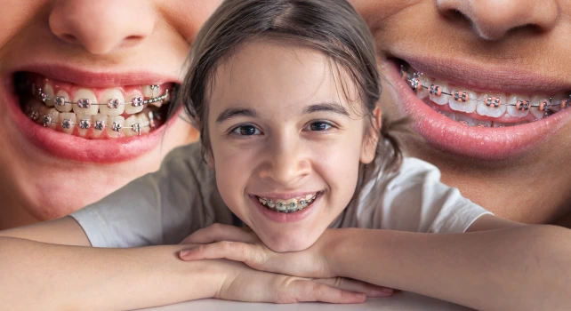 Crianças usando aparelho ortodôntico.