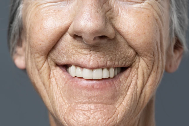 Mulher sorrindo com seu implante dentário imediato.