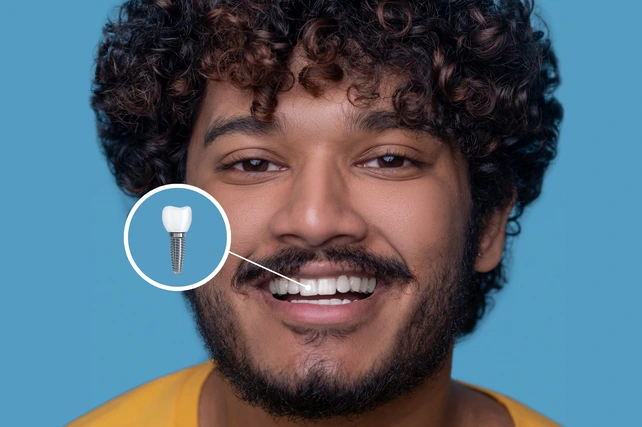 Jovem sorrindo com seu implante dentário.