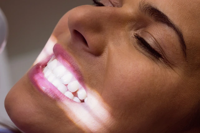 Mulher fazendo clareamento dental.